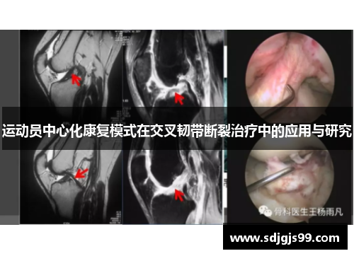 运动员中心化康复模式在交叉韧带断裂治疗中的应用与研究